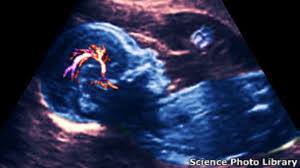 14/08/2021 EL ABORTO