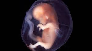 15/08/2021 ADDENDUM PARA EL FRACTAL ANTERIOR: EL ABORTO